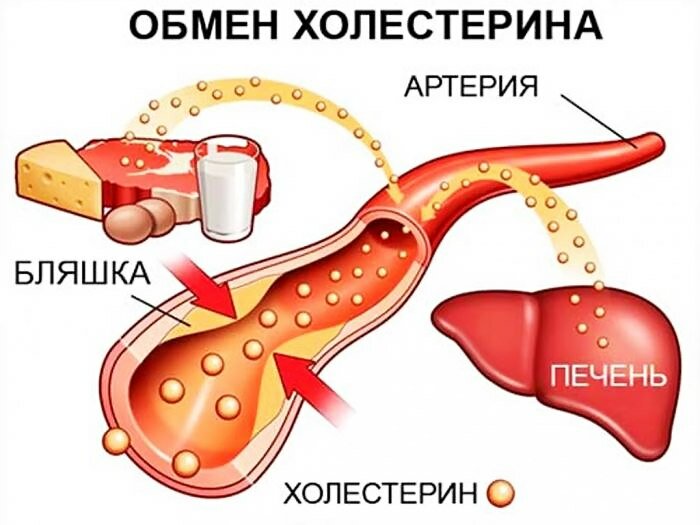 плохой холестерин