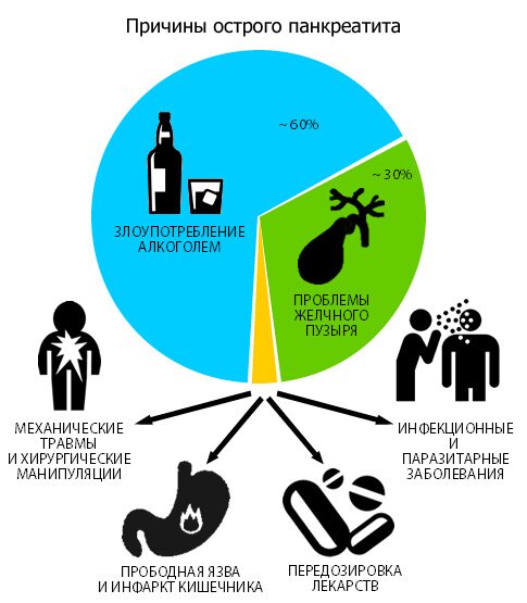 причины панкреатита